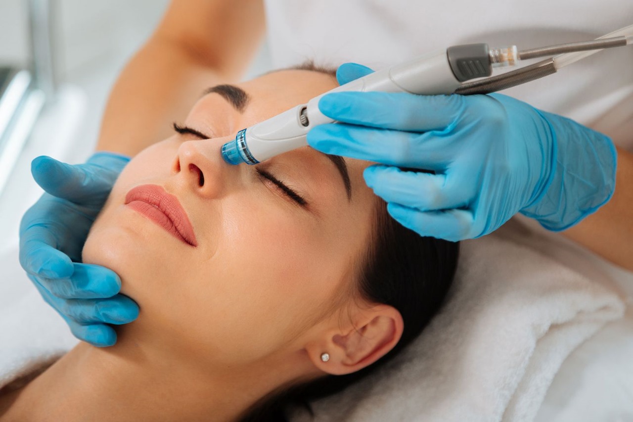 Laser Hair Removal